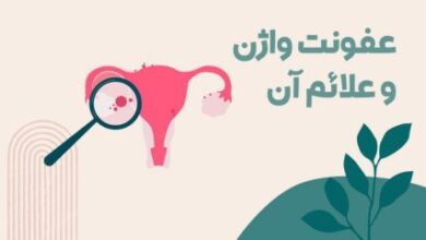 راه های پیشگیری از عفونت واژن در زنان