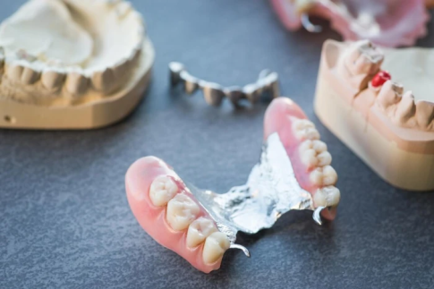 دندان مصنوعی بهتر است یا ایمپلنت؟ کدام را انتخاب کنیم؟!
