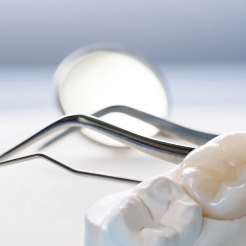 دندان مصنوعی بهتر است یا ایمپلنت؟ کدام را انتخاب کنیم؟!